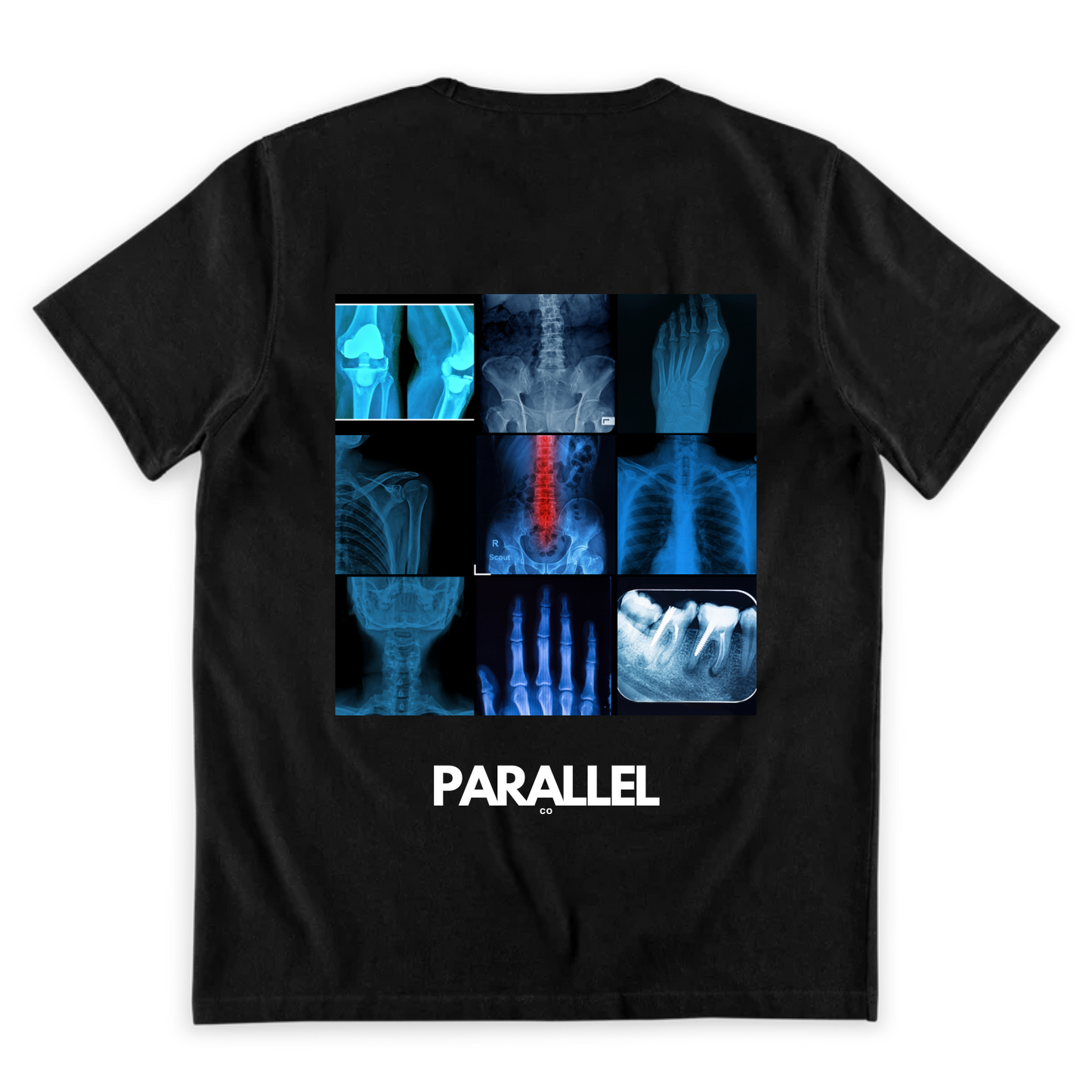 Xray Tee